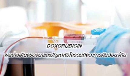 Doxorubicin ผลข้างเคียงของยาและปัญหาหัวใจรวมถึงอาการคันฮอดจ์กิน